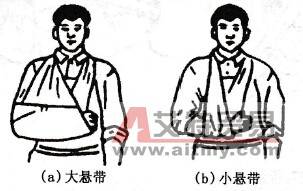 上肢创伤包扎法