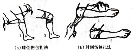 膝（肘）创伤包扎法
